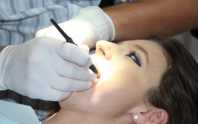 Zahnreinigung in der PKV: Hintergründe, Kostenübernahme & Ablauf